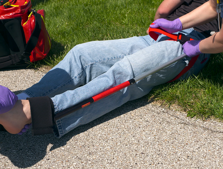 ATTELLE STS GENERATION 2 - TRACTION FEMUR SLISHMAN TRACTION SPLINT